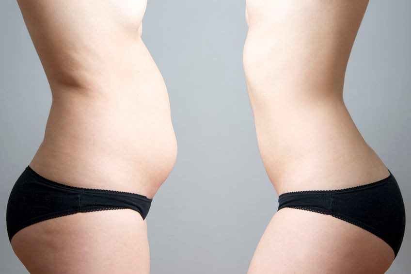 Obesity before after. Young woman's body on gray background.