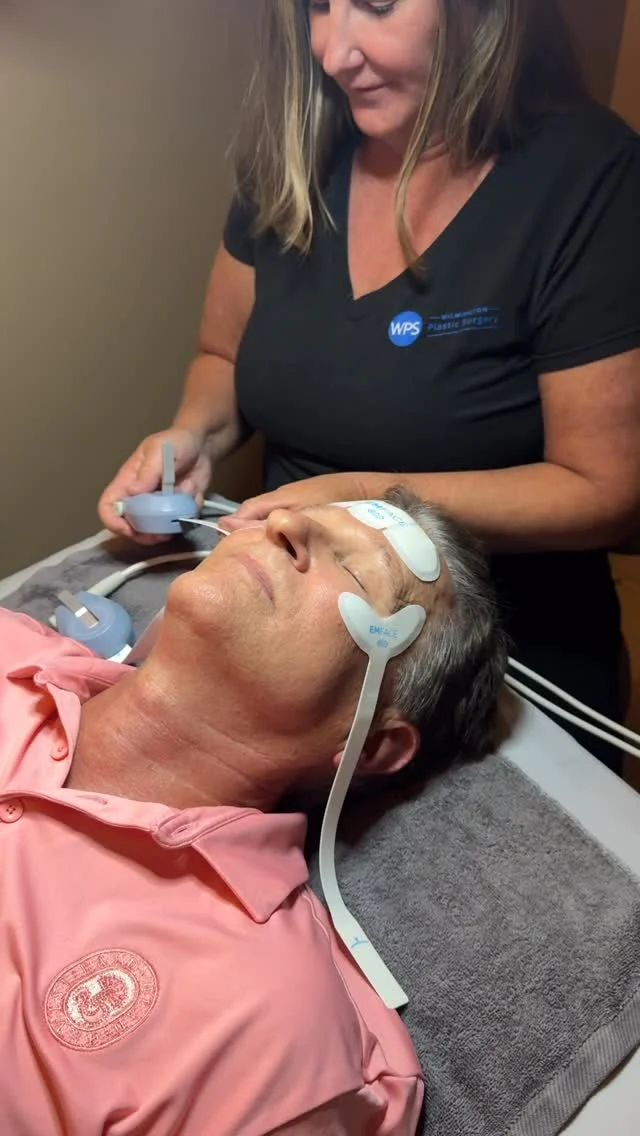 A familiar face on Sarah’s table for a full treatment of EmFace!🤩
•
Treating the upper face with EmFace targets the eyes and forehead. The combined RF and HIFES technology restores the muscles and soft tissue, to lift and smooth the skin while improving the appearance of under eye “bags”
•
Save on EmFace treatments with Summer Specials! ☀️ #wps #wpsmedspa #wilmingtonplasticsurgery #wilmingtonplasticsurgery #wilmingtonnc #medspa #medicalspa #emsculpt #emface #btlaesthetics